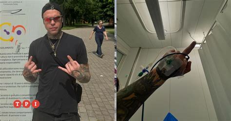 Fedez In Ospedale Con La Flebo Il Rapper Torna Sui Social E Rompe Il