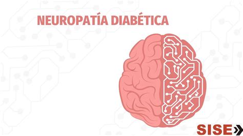 Res Menes De Neuropat A Diab Tica Descarga Apuntes De Neuropat A