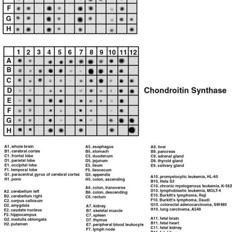 Rna Dot Blot Analysis Of Chondroitin Galnact And Chondroitin Synthase