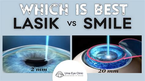 SMILE Eye Surgery What S Different Than LASIK