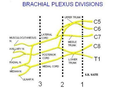 Brachial Plexus Injury Mri