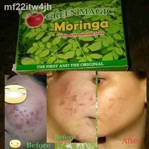 Codmoringa Soap Skin Asthmaantibacterialdry Skin Shopee Philippines