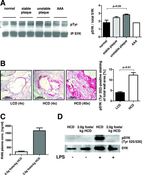 The Oral Spleen Tyrosine Kinase Inhibitor Fostamatinib Attenuates