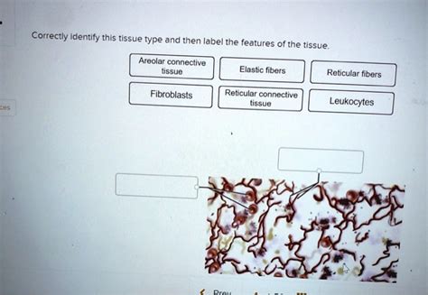 Solved Correctly Identify This Tissue Type And Then Label The Features