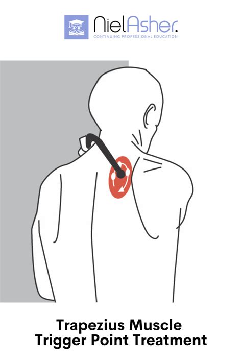 Trigger Point Therapy Treating Pectineus Artofit