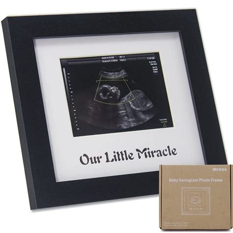 Baby Sonogram Picture Frame Ultrasound Picture Frame Sonogram Photo