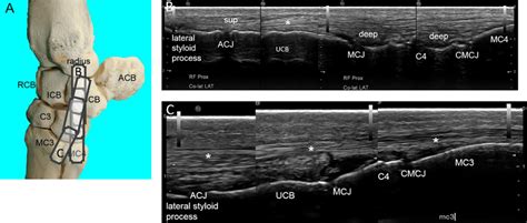 Ultrasonography of the Carpus | Veterian Key