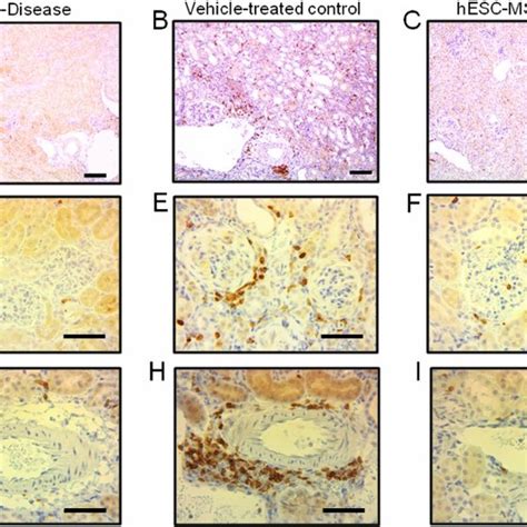 Hesc Msc Treatment Reduces Renal Immune Cell Infiltration In Bwf1 Mice Download Scientific