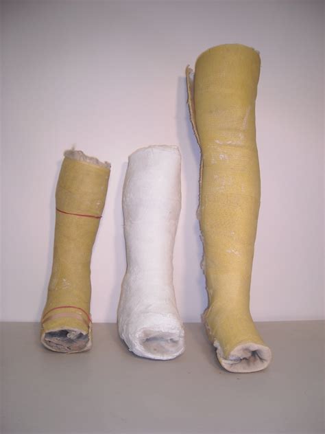 Plaster cast (leg)