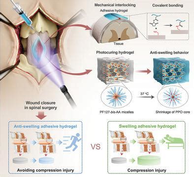 An Injectable Rapid Adhesion And Anti Swelling Adhesive Hydrogel For