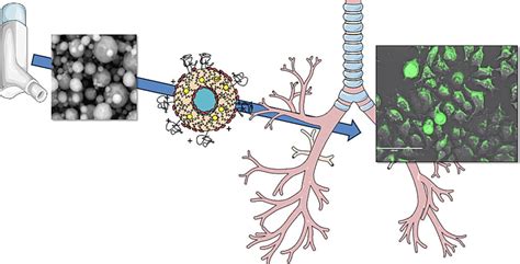 Inhaled Dry Powder Liposomal Azithromycin For Treatment Of Chronic