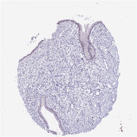 Tissue Expression Of Shcbp1 Staining In Cervix The Human Protein Atlas