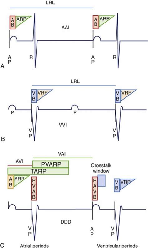 Cardiac Pacing Modes and Terminology | Thoracic Key