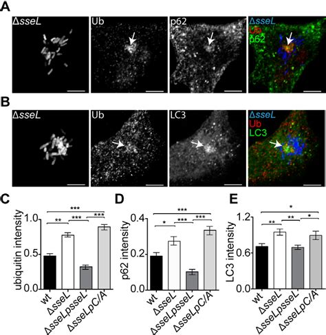 Figure From The Salmonella Deubiquitinase Ssel Inhibits Selective