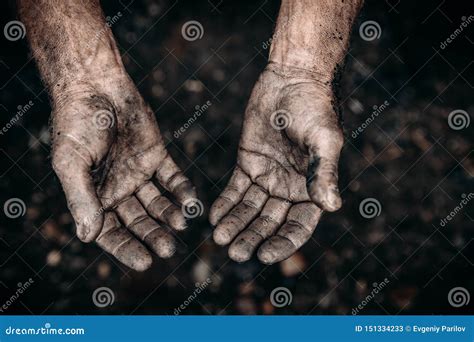 Dirty Hands Of Worker Miner Are Corns Palms In Abrasions Concept Hard