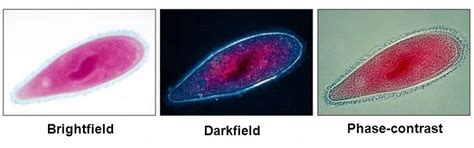 What is bright field, phase contrast, dark field, polarizing, DIC ...