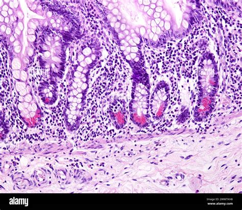 Small Intestine Paneth Cells Light Micrograph Stock Photo Alamy