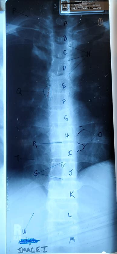 T Spine Ap Diagram Quizlet