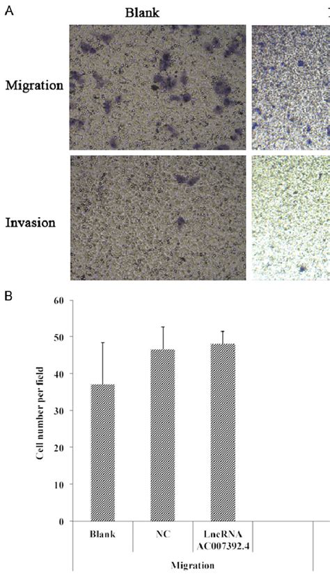 Effects Of Lncrna Ac0073924 Overexpression On Cal 27 Cells Migration