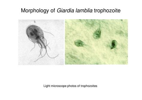 Giardiasis Giardia Lamblia Giardia Intestinalis Online Presentation