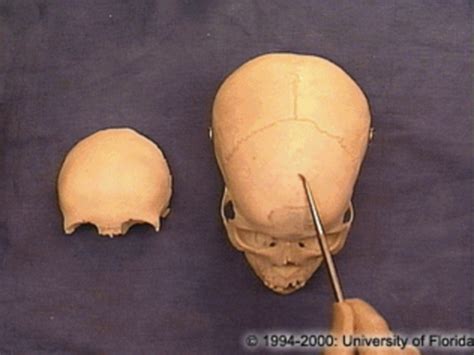 Anatomy Week Material Cranial Fossa Brain And Orbit Flashcards