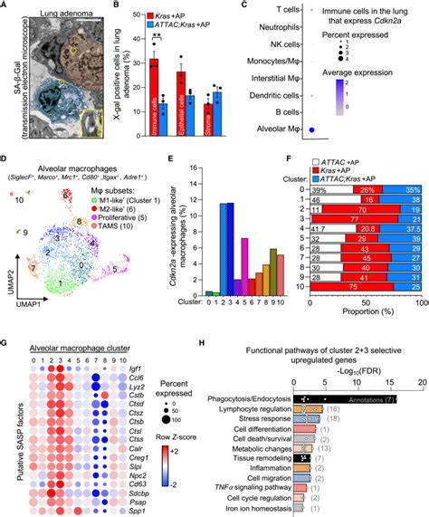 Senescent Alveolar Macrophages Promote Early Stage Lung Tumorigenesis