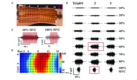 A Placement Of High Density Surface Emg Grids B An Example Of