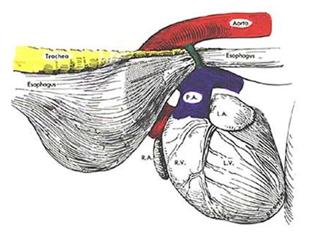 Persistent right aortic arch – Vets on the Balkans - an online journal for veterinarians from ...