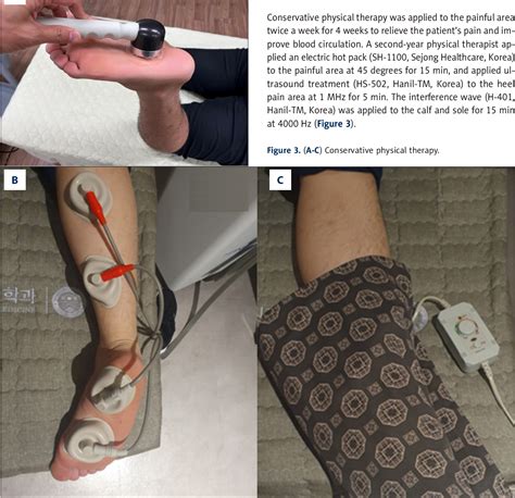 Figure 1 From Effect Of Dynamic Taping Versus Kinesiology Taping On