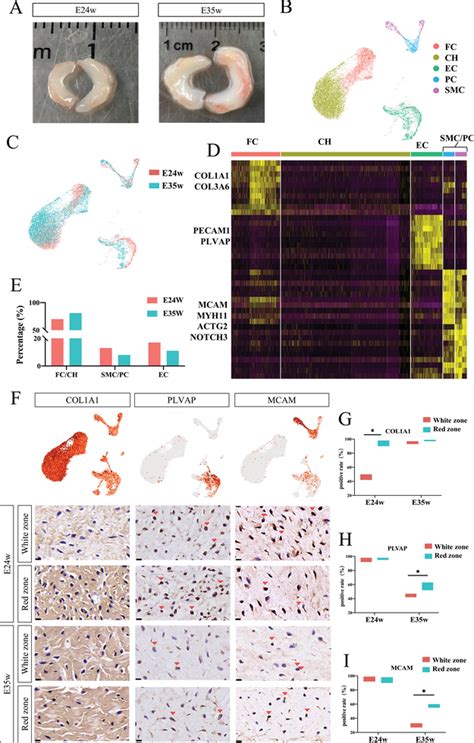 Heterogenicity Of Meniscus Cells And Spatiotemporal Characterization Of