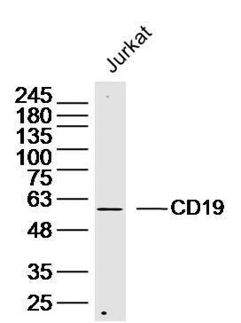 Cd Rabbit Anti Human Polyclonal Bioss L Unconjugated