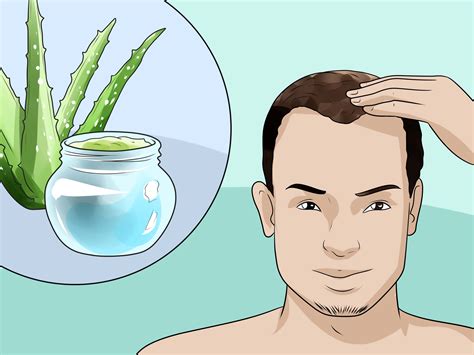 17 Hair Loss Treatments For Men