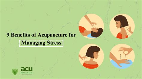 Benefits Of Acupuncture For Managing Stress