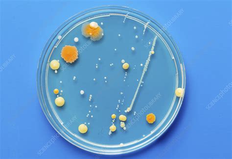 Cultures Growing On Petri Dish Stock Image F Science