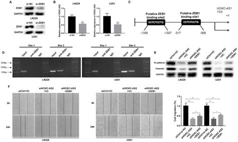 Zeb1 Activates Hoxc As2 Expression At Transcriptional Level A Zeb1