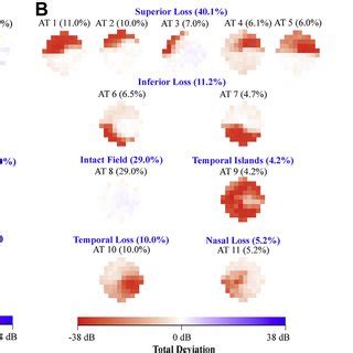 (PDF) Artificial Intelligence Classification of Central Visual Field ...