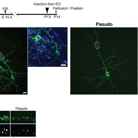 Cortical Injection Of Pkm Inhibitory Pseudosubstrate Suppresses