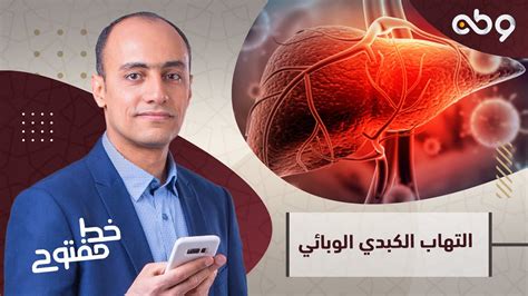 التهاب الكبدي الوبائي أسبابه وطرق علاجه وطن Watanegypt