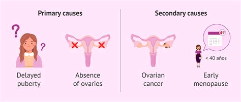 Causes of irregular menstruation