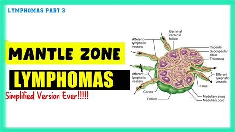 Mantle Zone Lymphoma Simplified Speedy Medical Youtube