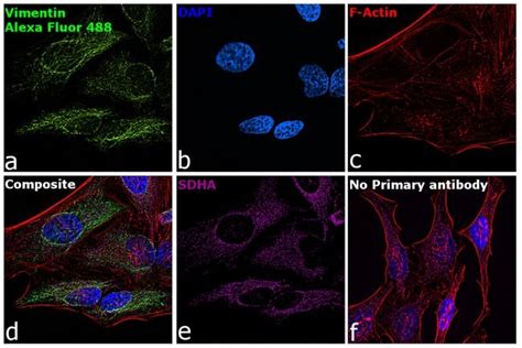 Donkey Anti Chicken Igy H L Highly Cross Adsorbed Secondary Antibody