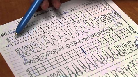 Full Mouth Probing Paper Charting | Dental videos, Dental assistant, Chart