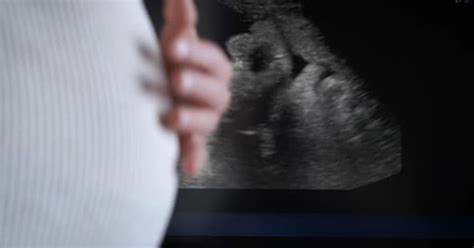 Ultrasound of the baby in the womb., Stock Video - Envato Elements