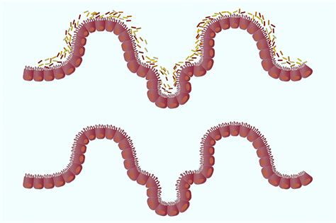 Intestino grueso | Qué es, ubicación, función, partes, información | Órgano