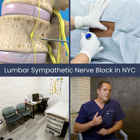 Lumbar Sympathetic Nerve Block In NYC Back Pain Doctors Specialists