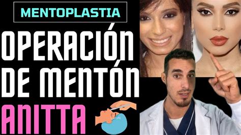 ANITTA cirugía plástica antes y después MENTOPLASTIA operación