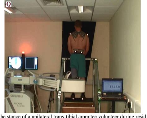 Figure 1 From EVALUATION OF ANGULAR KINEMATICS OF LOWER LIMB AMPUTEES