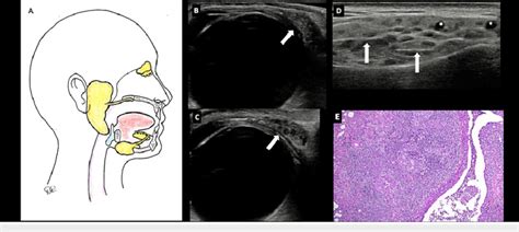 A Anatomical Representation Of The Salivary And Lacrimal Glands