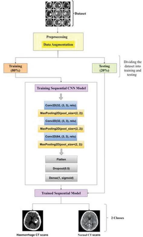 Figure 1 From Enhancing Haemorrhage Detection In Head CT Scans Using