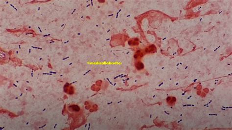 Klebsiella Pneumoniae Gram Stain Introduction Principle Procedure Hot